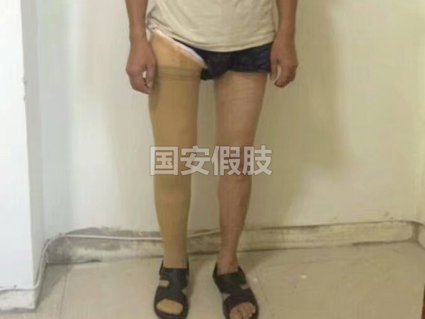 長(zhǎng)沙國(guó)安假肢康復(fù)用品有限公司,長(zhǎng)沙假肢用品,國(guó)安假肢康復(fù)用品,假肢矯形器,康復(fù)器材,假肢配件,矯形器支具